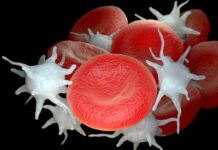 Methemoglobinemi Nedir?