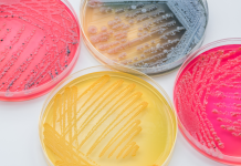 Lenfogranüloma Venereum Nedir?