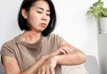 Gebelik Pemfigoidi Nedir?