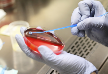 Anti Tübüler Bazal Membran Nefriti Nedir?